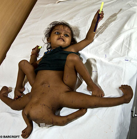 vishnu-before01.jpg