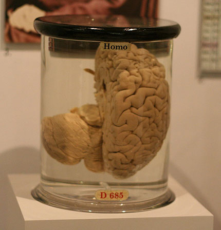 cerebro-babbage.jpg