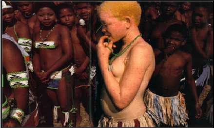 albino.gif