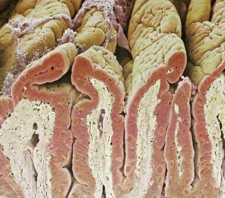 imagen-del-intestino-delgado.jpg