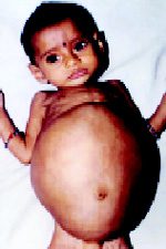Fetus.jpg
