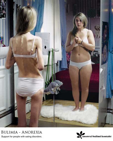 anorexia-y-bulimia.jpg