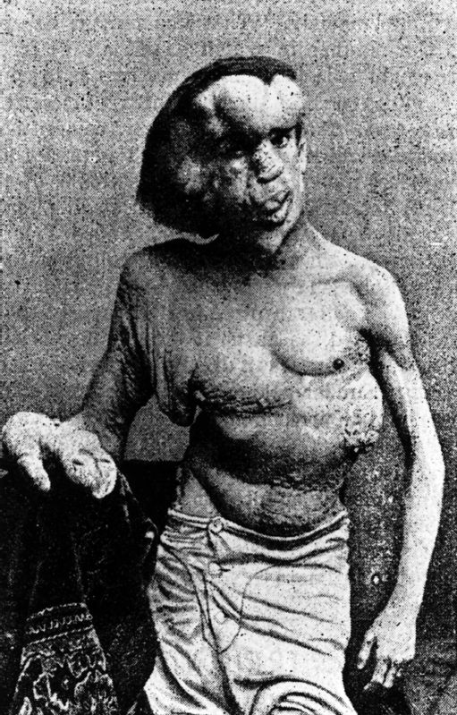 elephant_man.jpg