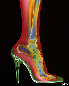120703183203_zapato_radiografia_224x280_spl.jpg