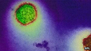 120907000252_hantavirus_304x171_spl_nocredit.jpg